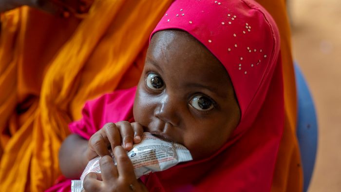 A 2-year-old girl sits on the lap of her mother, and eats from a sachet of ready-to-use therapeutic food (RUTF) after being assessed for malnutrition at the outpatient therapeutic centre.