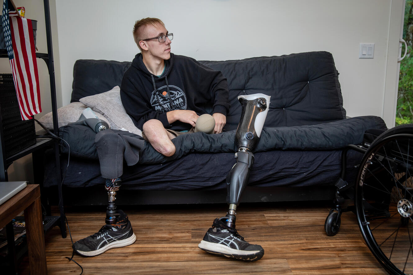 A young man sits on a couch with his prosthetic legs leaning on the couch