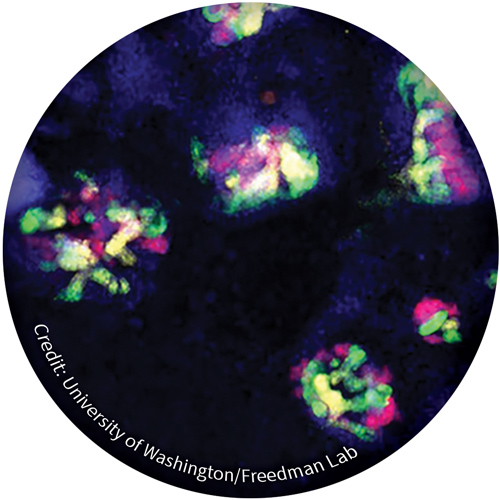 Organoid | Credit: University of Washington/Freedman Lab