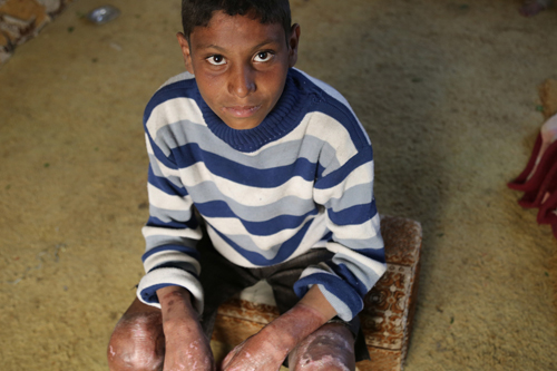 Zuhair*, 13 years old, Yemen. Photo by Anas Shahari/Save the Children. Zuhair*, 13 years old, Yemen. Photo by Anas Shahari/Save the Children.